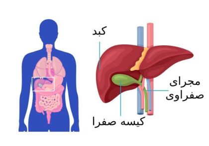 کیسه صفرا