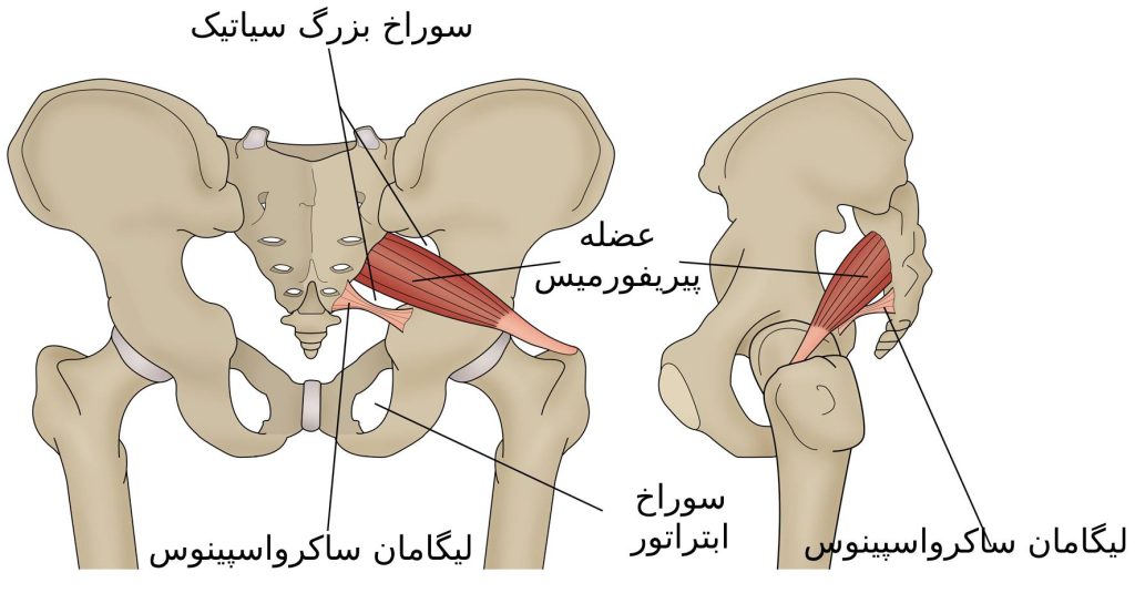 سندرم پیریفورمیس