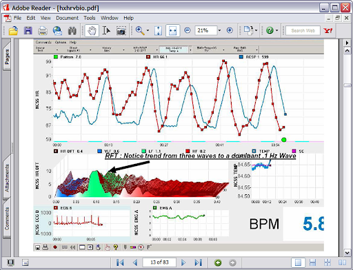 hrv-chart